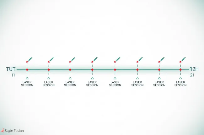 A visual timeline depicting the progression and commitment required for effective facial laser hair removal treatments.